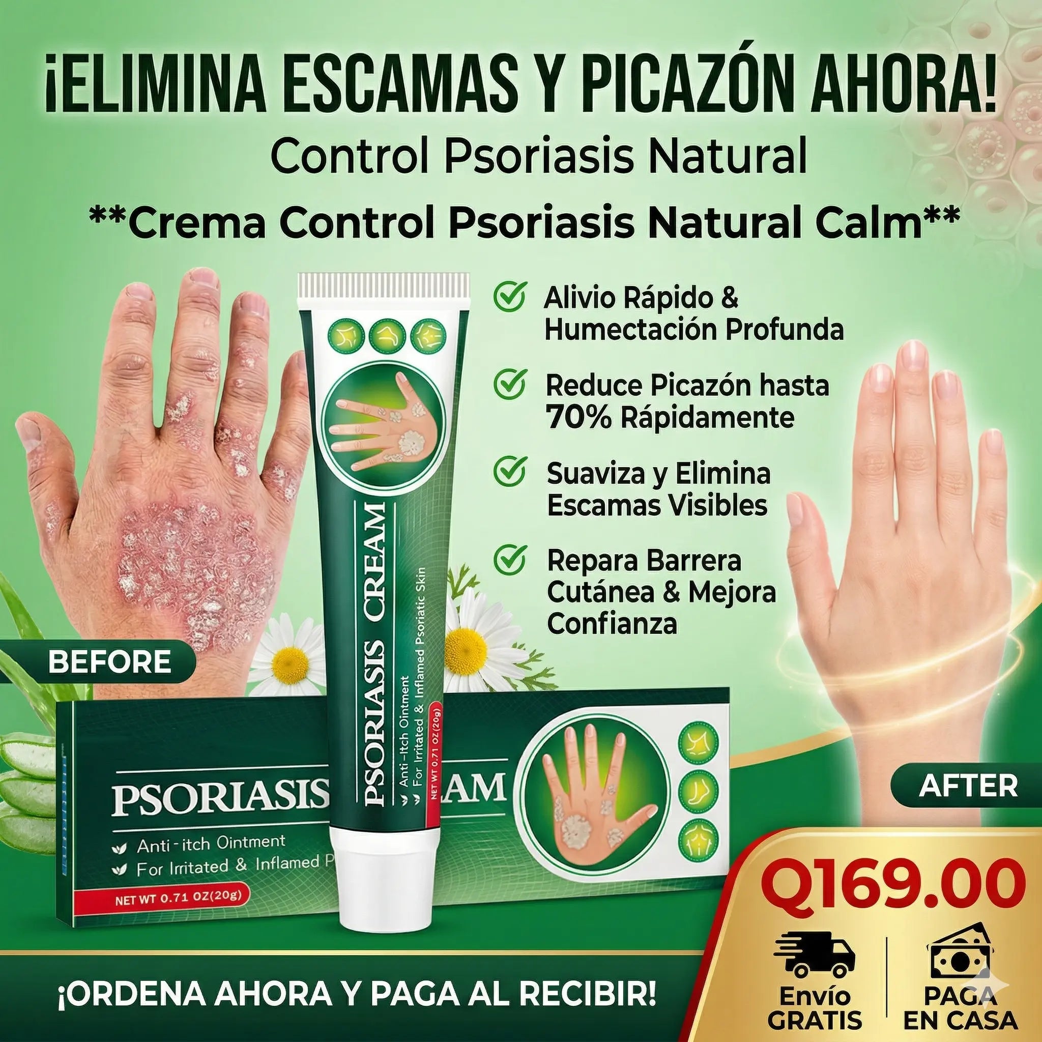 Crema Control Psoriasis Natural Calm